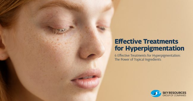 Effective Treatments for Hyperpigmentation